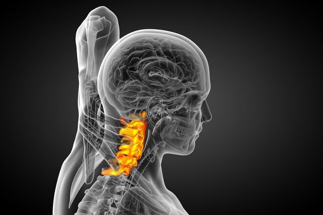 How to prevent cervical spine injuries